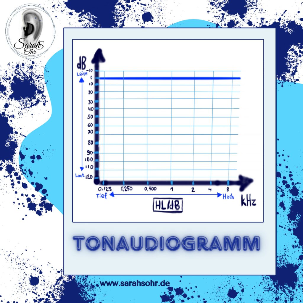 Abbildung Tonaudiogramm ohne Werte