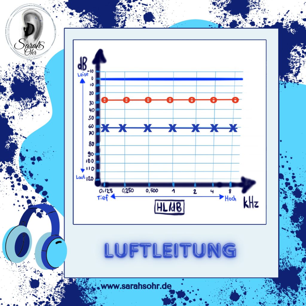 Luftleitungswerte im Tonaudiogramm