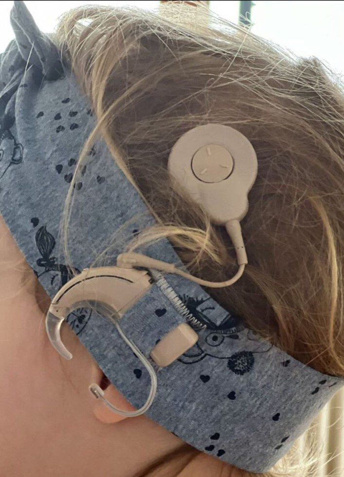 Kind trägt gleichzeitig ein Cochlea Implantat und ein Hörgerät mit Kopfband.