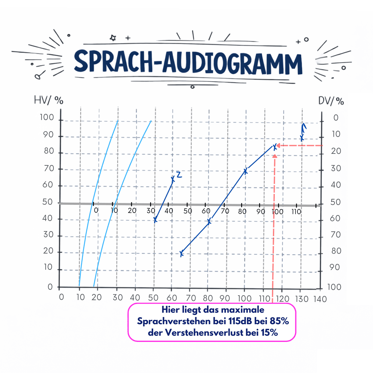 Sprachaudiogramm mit Beispiel für maximales Sprachverstehen links bei 115 dB und 15 Prozent Verstehensverlust.