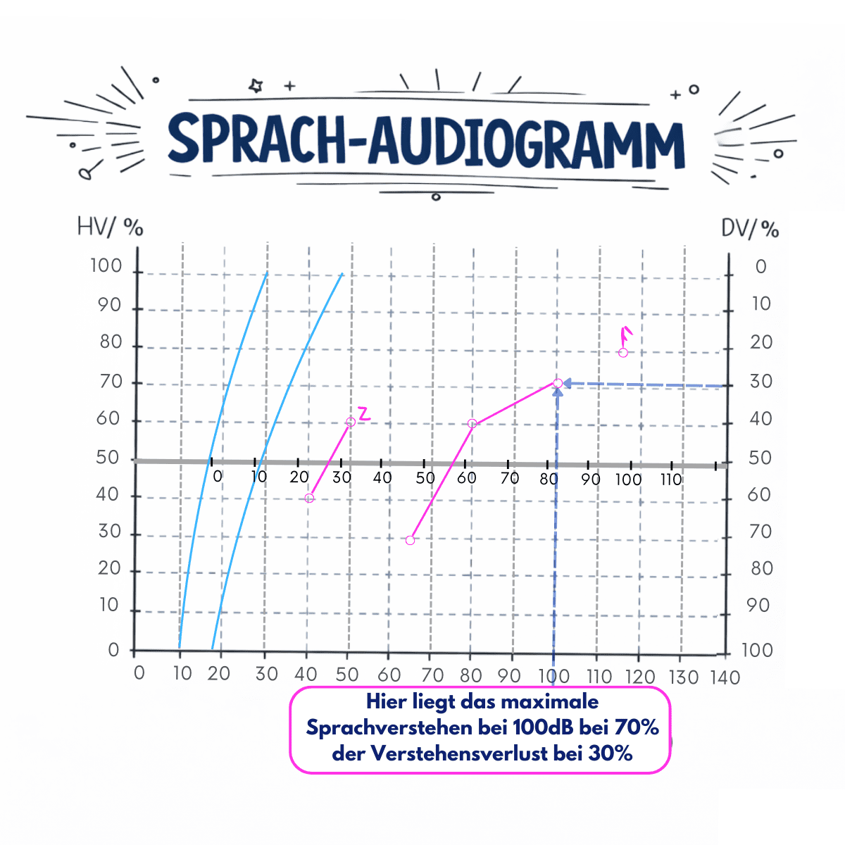 Sprachaudiogramm mit Beispiel für maximales Sprachverstehen rechts bei 100 dB und 30 Prozent Verstehensverlust.