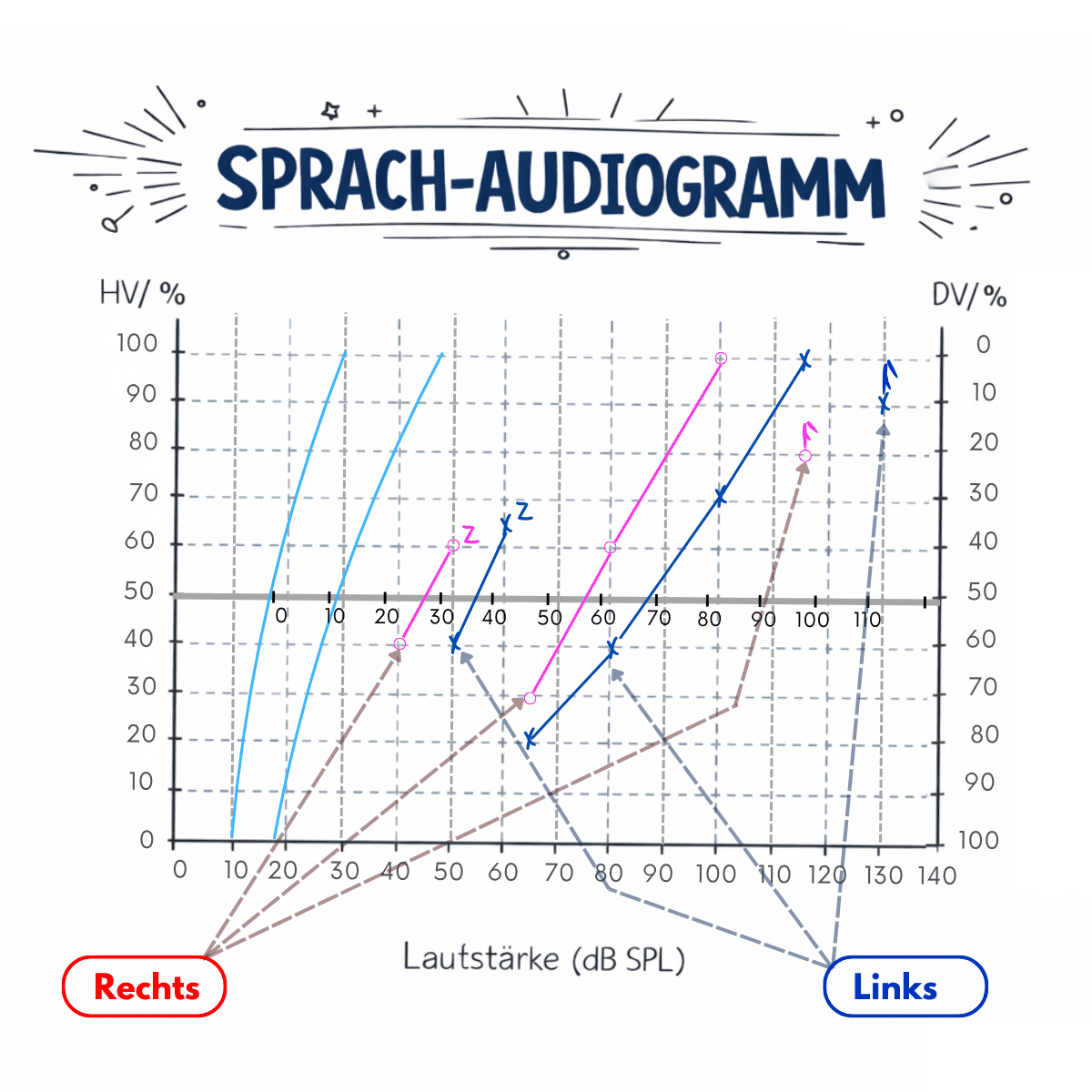 Sprachaudiogramm mit farblich markierten Kurven für rechtes und linkes Ohr.