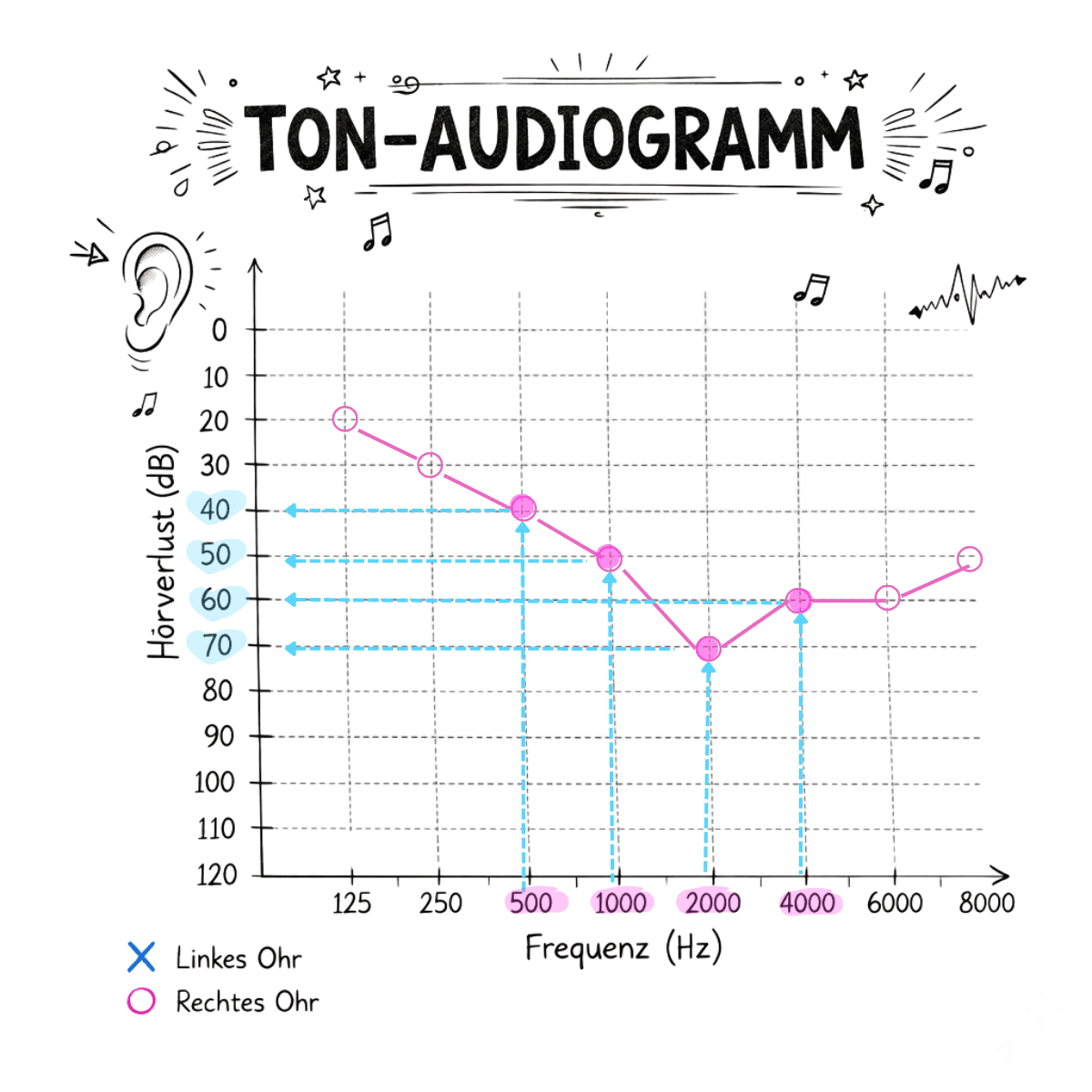 Beispiel eines Tonaudiogramms. Markiert sind die Frequenzen 500, 1000, 2000 und 4000 Hz sowie die dazugehörigen Hörverlust-Werte in dB, die für die GdB-Berechnung relevant sind.
