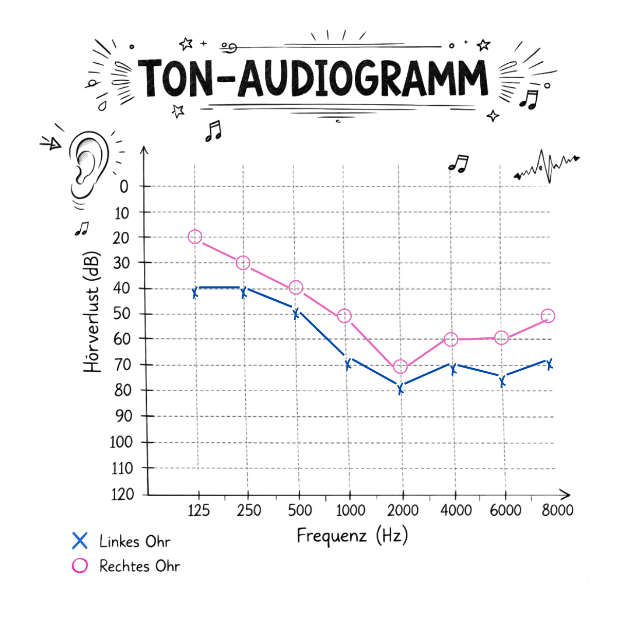 Tonaudiogramm mit markierten Luftleitungswerten.