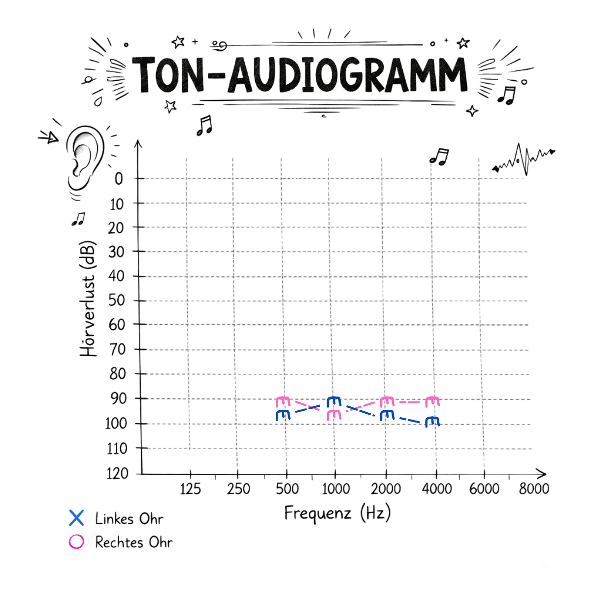 Tonaudiogramm mit markierter Unbehaglichkeitsschwelle.